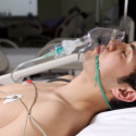 young man w-O2 mask in ICU
